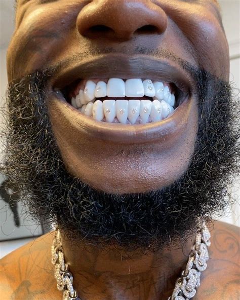 is gucci manes teeth fake|gucci mane bands.